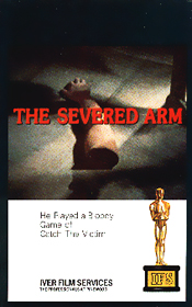Random Coverscan
