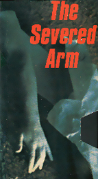 Coverscan of The Severed Arm